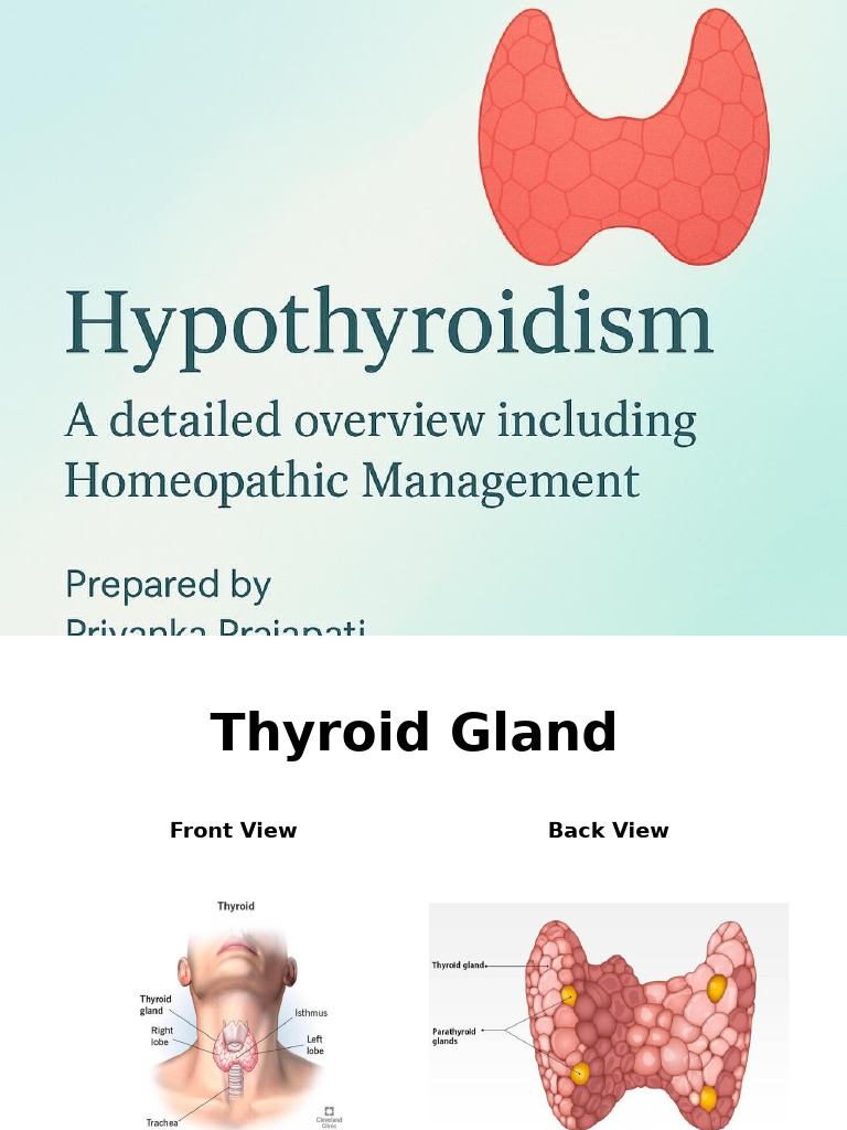 Overview of Hypothyroidism Management | PDF | Hypothyroidism | Thyroid