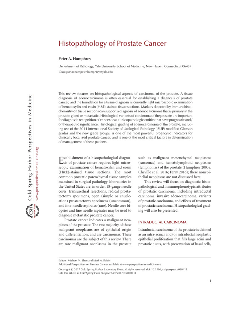 HISTOPATHOLOGY of Prostate Cancer | PDF | Adenocarcinoma | Carcinoma