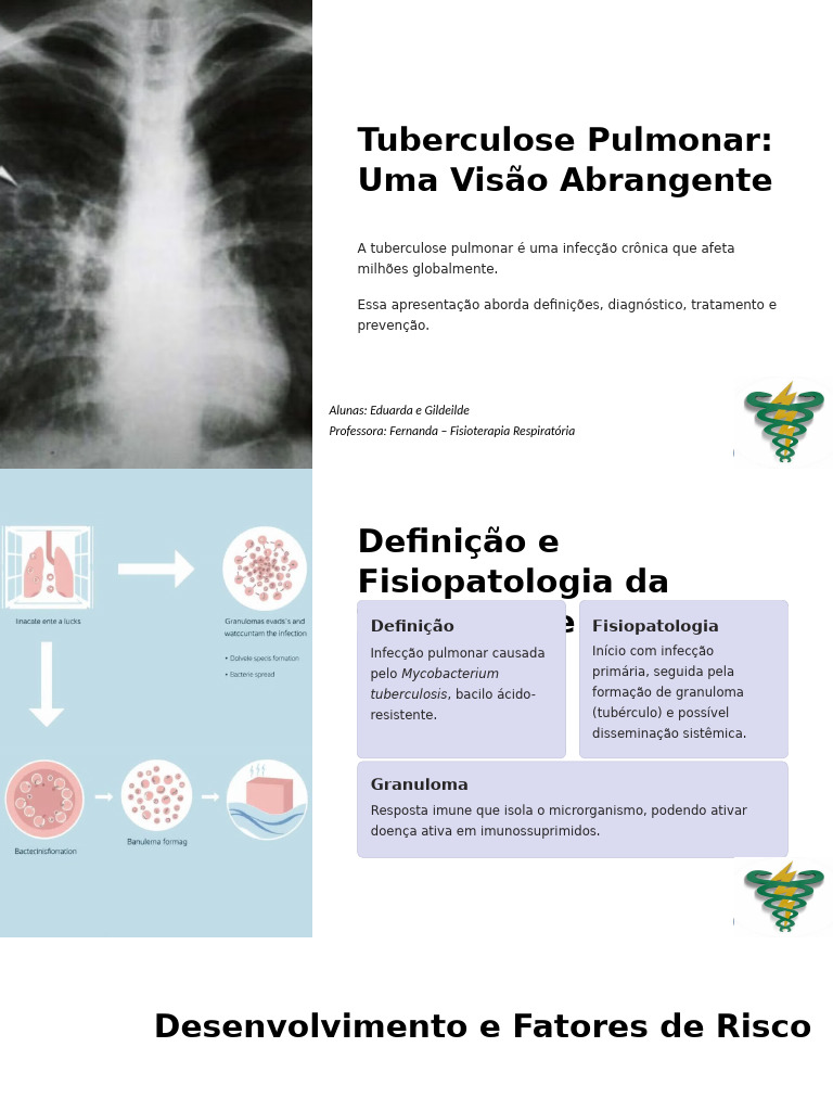 Tuberculose Pulmonar Uma Visao Abrangente | PDF | Tuberculose ...
