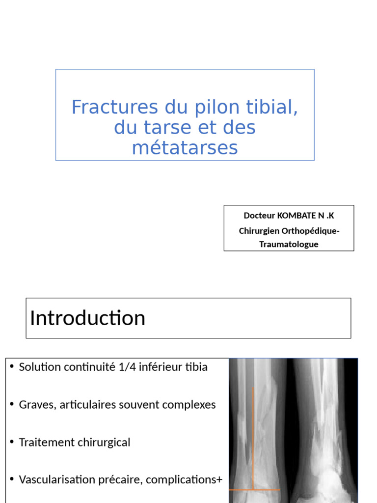 Fractures du pilon tibial et traitement | PDF | Pied | Appareil locomoteur