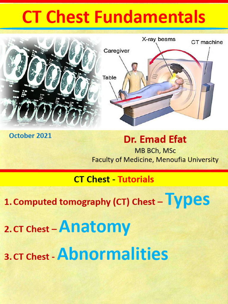 Ctchestfundamentals 240504092517 87cc0da3 | PDF | Lung | Ct Scan