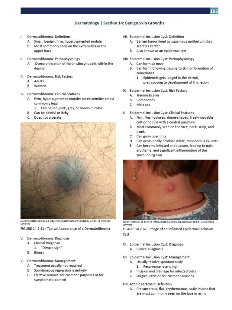 Section 14 - Benign Skin Growths | PDF | Epidermis | Medical Specialties