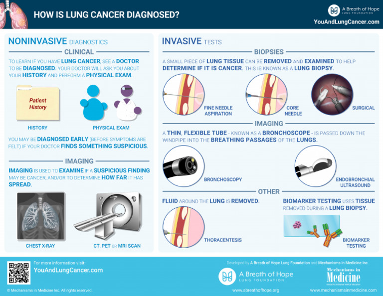 Lung Cancer Diagnosing Infographic | PDF