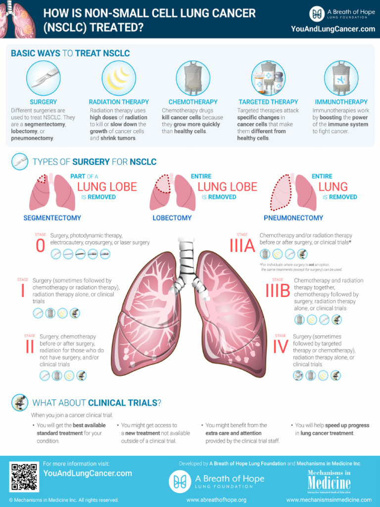 Non Small Cell Lung Cancer Treatment Infographic | PDF