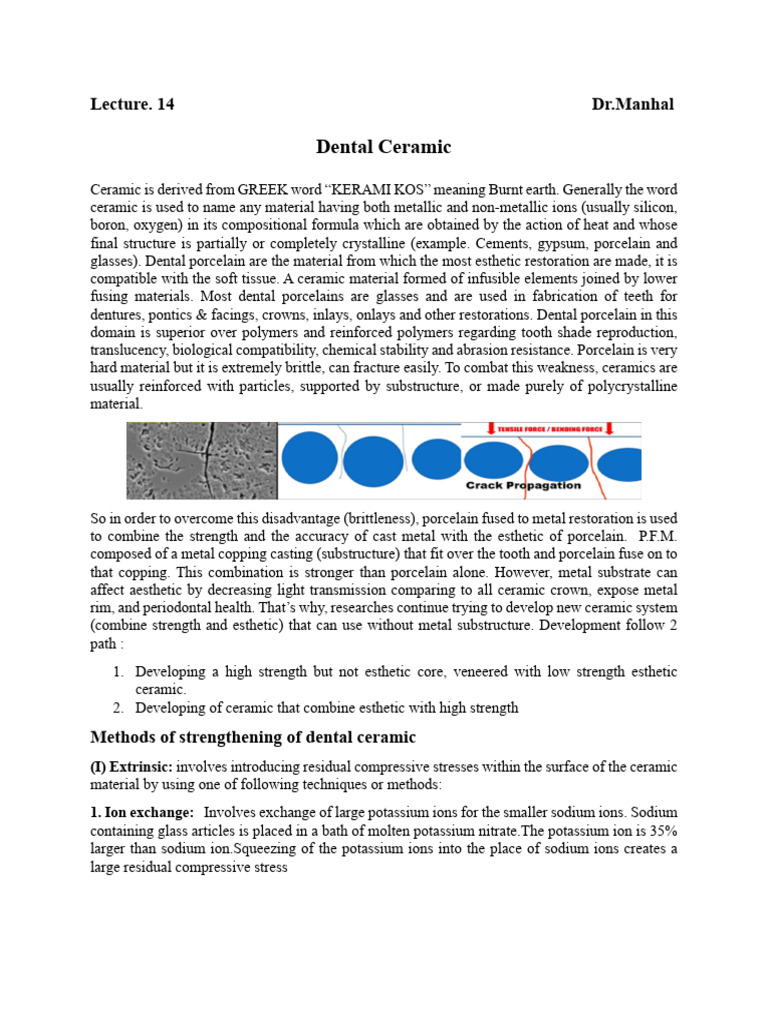Dental Ceramics: Types and Strengthening Methods | PDF | Zirconium ...