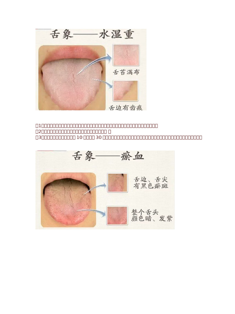 舌诊（舌象）知识小汇总 | PDF