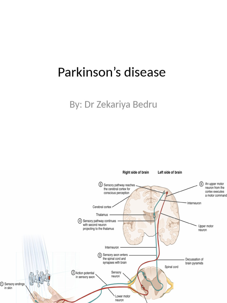 Parkinson's Disease Zak | PDF | Parkinson's Disease | Dopamine