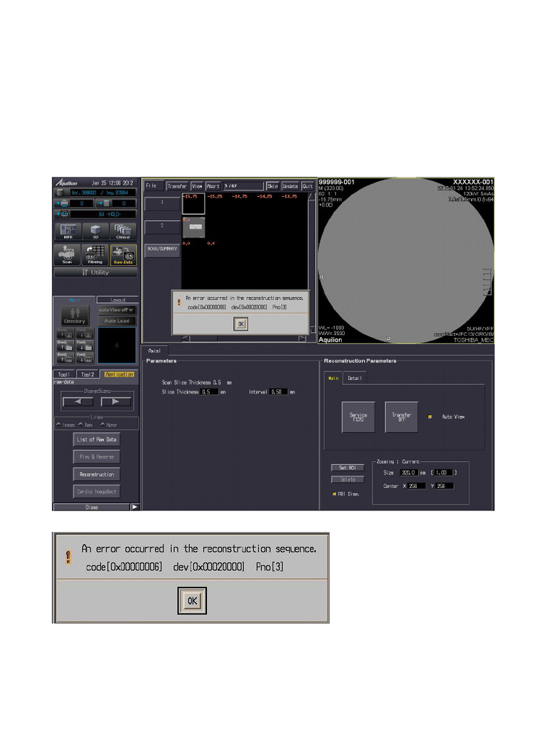 AquilionCXL - An Error Occurred in The Reconstruction Sequence | PDF