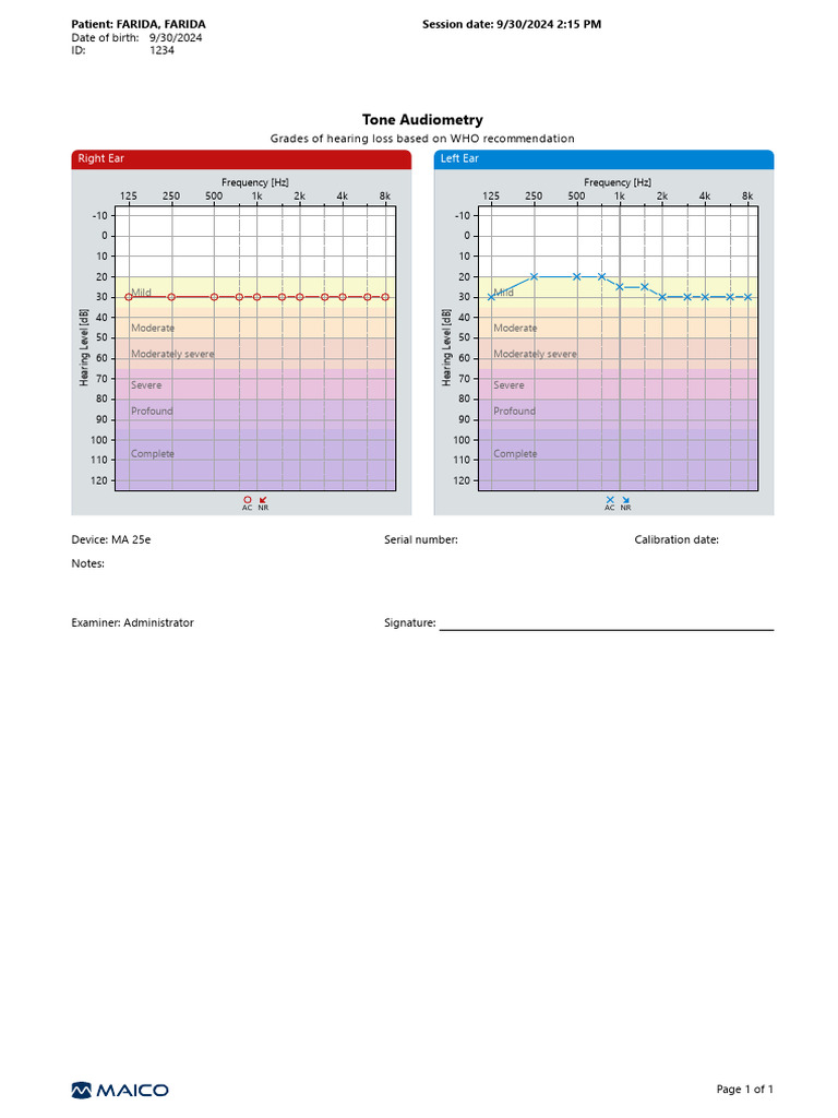 Tone Audiometry Hearing Loss Report | PDF | Sound | Acoustics