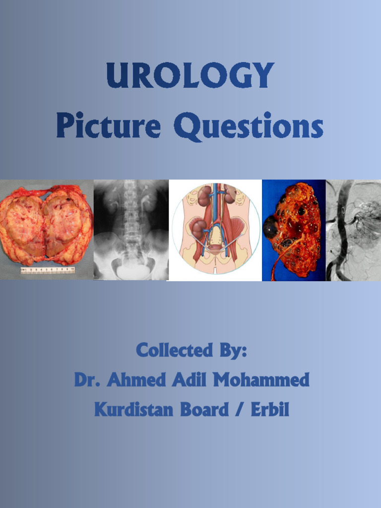 Urology Exam Questions and Answers Guide | PDF | Urology | Medical ...