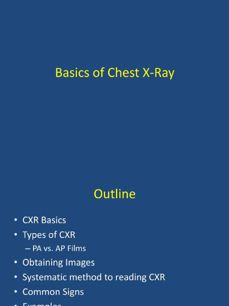Basics of Chest X-Ray | PDF