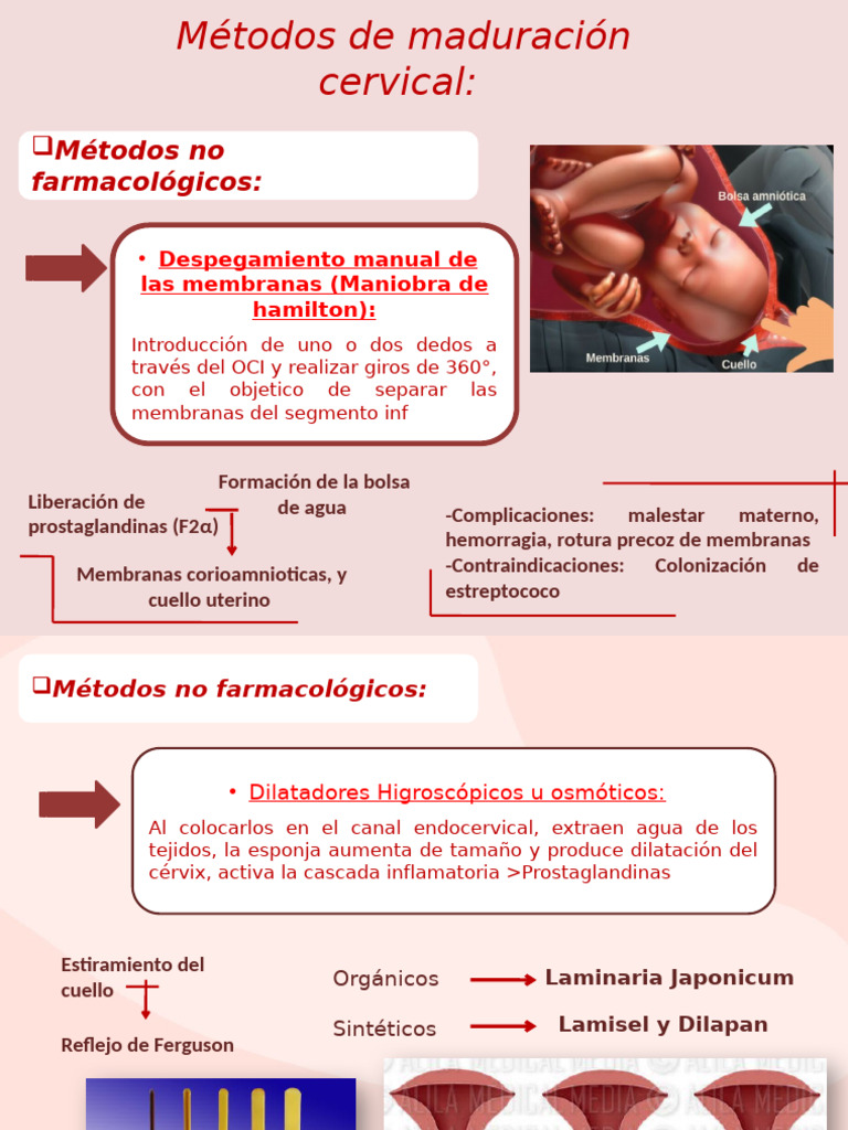 Métodos de maduración cervical eficaces | PDF | Prostaglandina