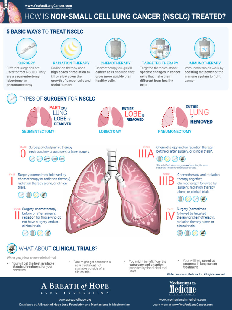 Non Small Cell Lung Cancer Treatment Infographic | PDF | Radiation ...