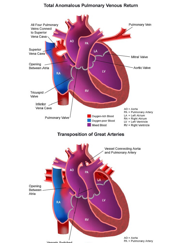 Congenital Heart Defects | PDF