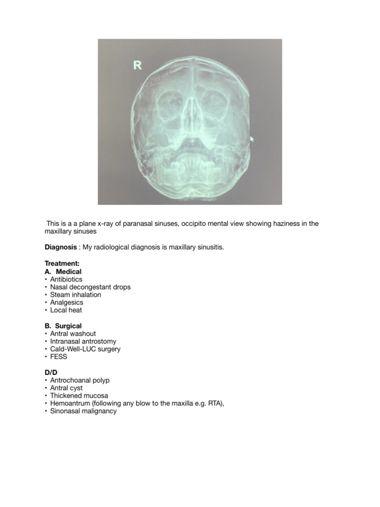 Blank-2 Ent Mastermind | PDF