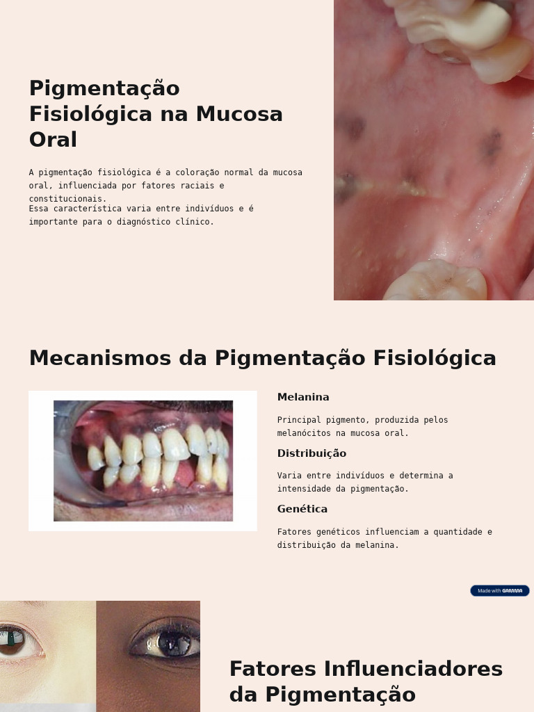 Pigmentacao Fisiologica Na Mucosa Oral | PDF | Boca | Medicina Clínica, image size:768x1024