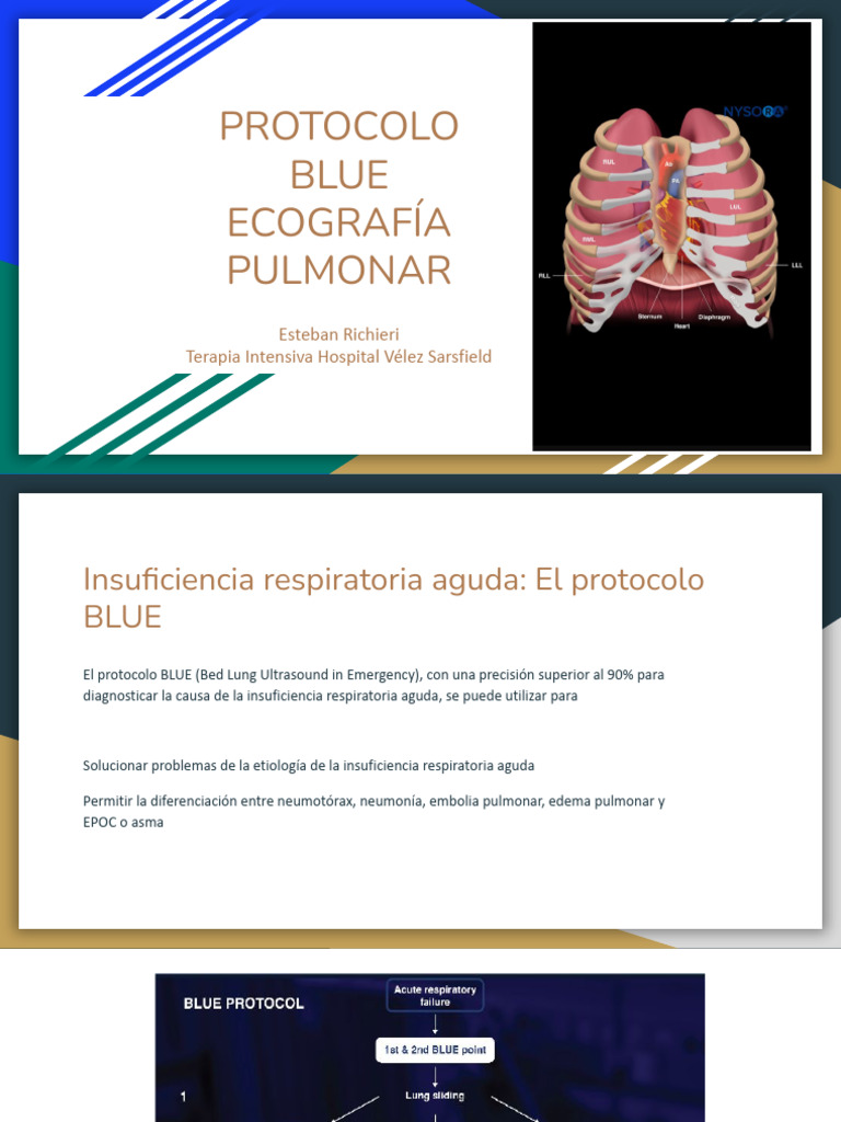 Protocolo BLUE en Ecografía Pulmonar | PDF
