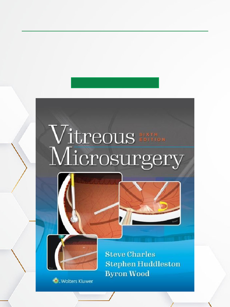 健康・医学 Vitreous Microsurgery Amazon | Vitreous Microsurgery | Calzada, Jorge, Wood, Byron