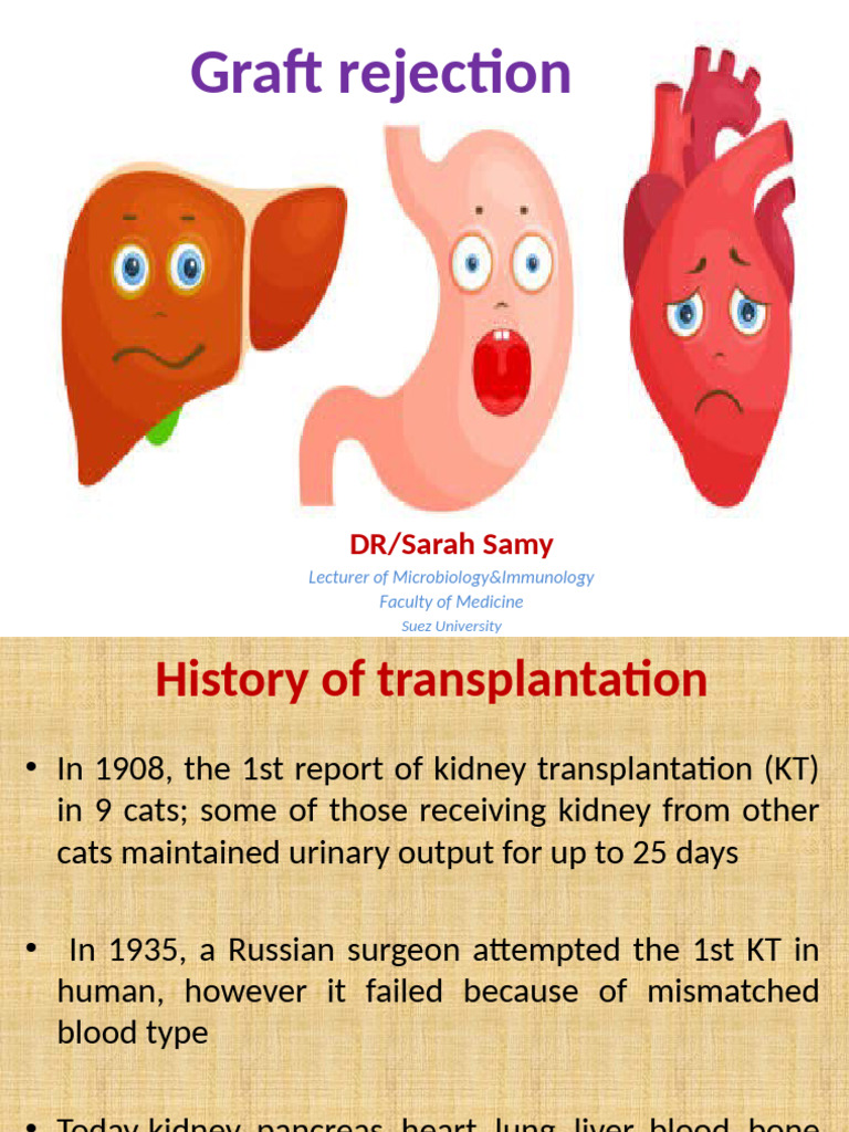 Understanding Graft Rejection Mechanisms | PDF | Transplant Rejection ...