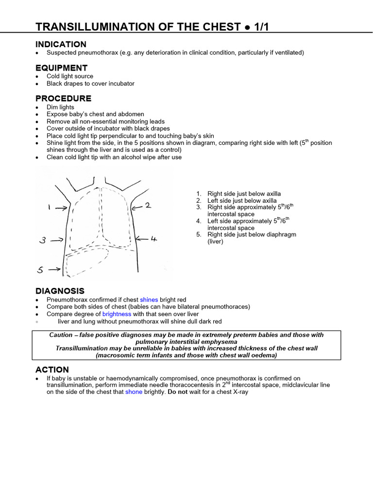 Transillumination of The Chest | PDF