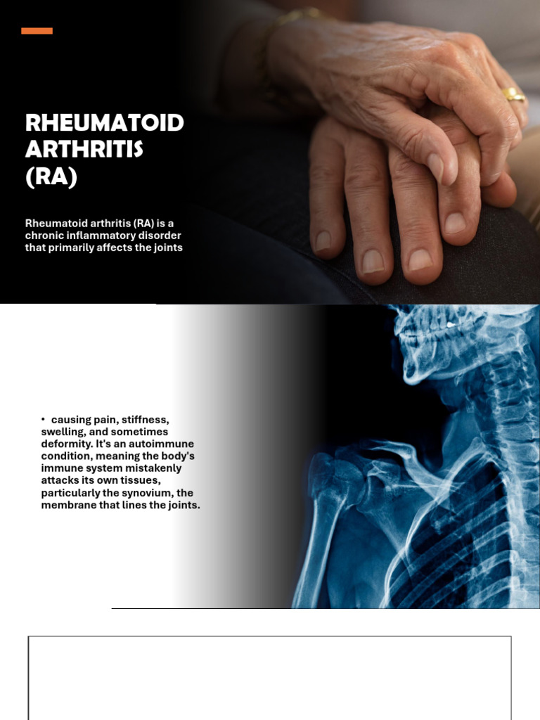 Rheumatoid Arthritis (Ra) | PDF