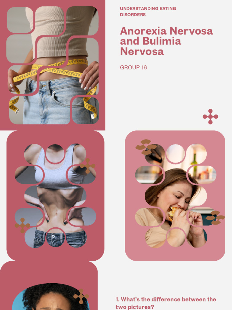 Understanding Eating Disorders Anorexia Nervosa and Bulimia - 20250513 ...