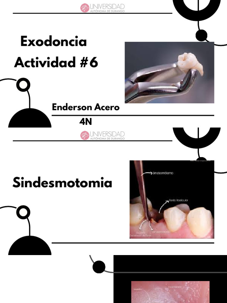 Sindesmotomía: Procedimiento y Instrumental | PDF