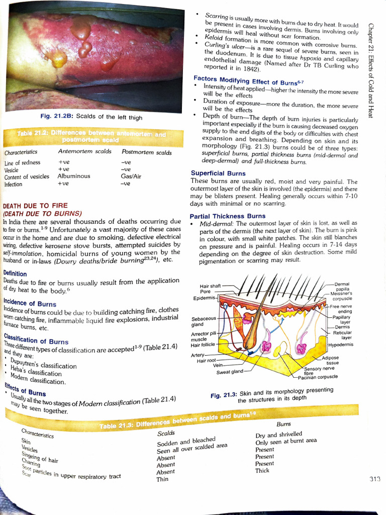 Burn Injuries | PDF | Burn | Skin