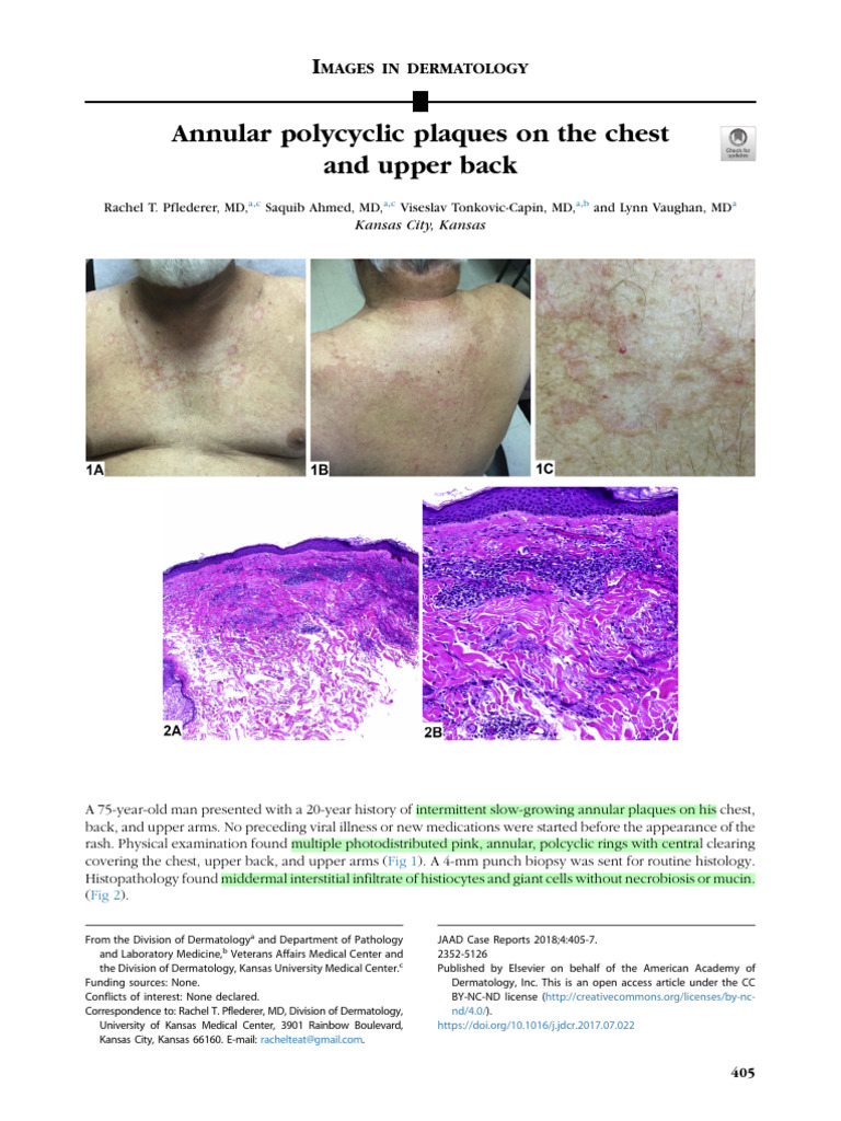 Annular Polycyclic Rash Diagnosis | PDF | Medical Specialties ...