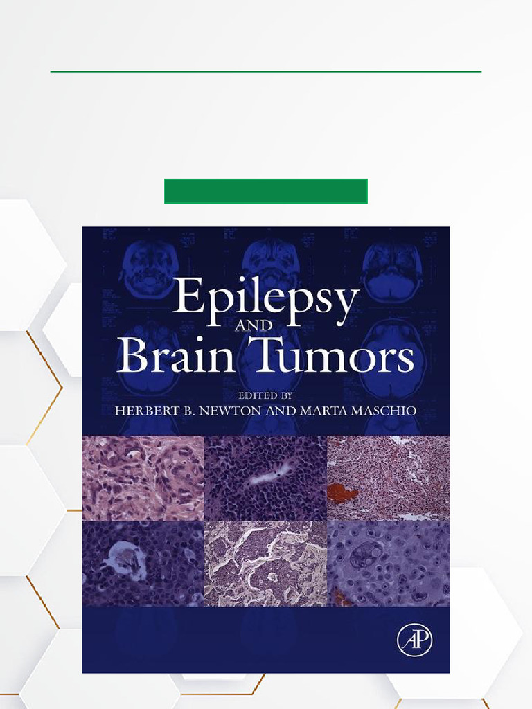 Epilepsy and Brain Tumors Scribd Download | PDF | Epilepsy | Glioma