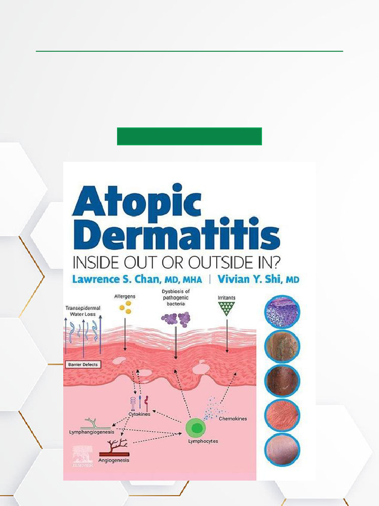Atopic Dermatitis Inside Out or Outside in E Book Complete Chapter
