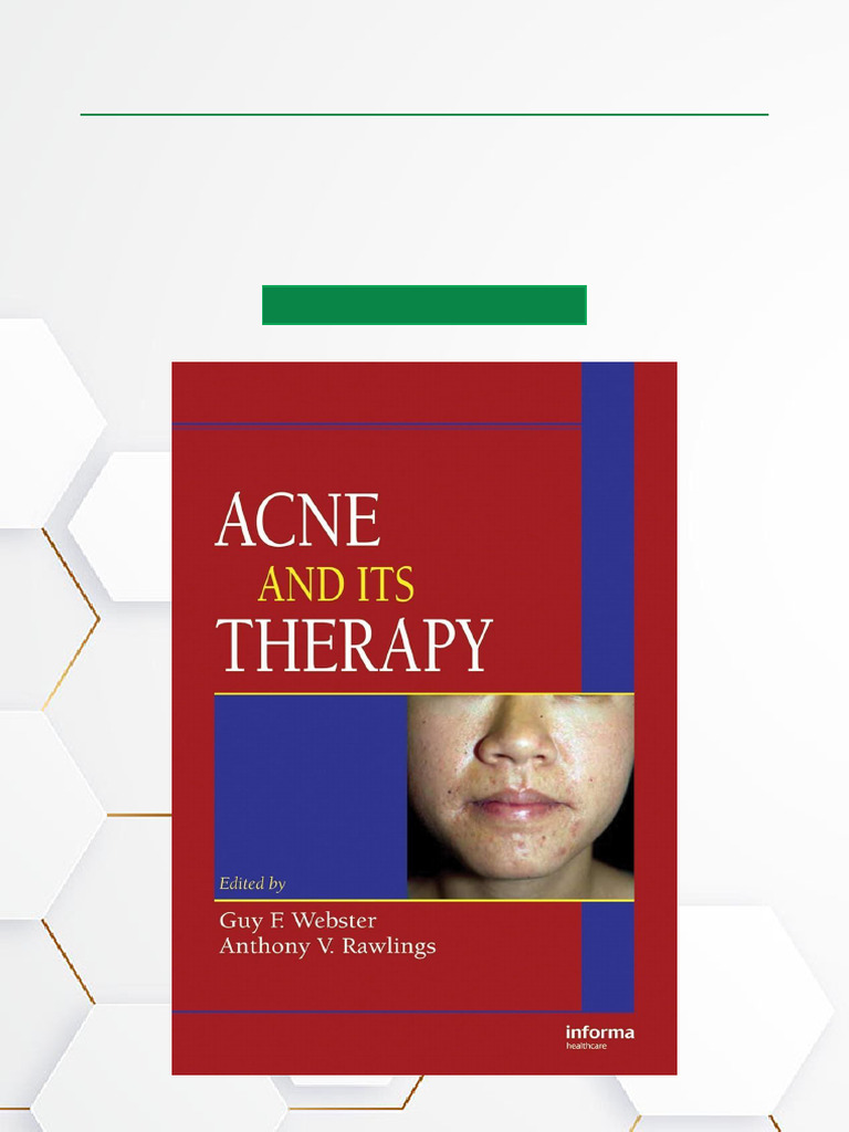 Acne and Its Therapy 1st Edition Full-Resolution Download | PDF ...