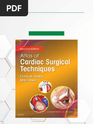英語版　CARDIAC SURGERY Operative Technique Cardiac Surgery: Operative Technique - Expert Consult