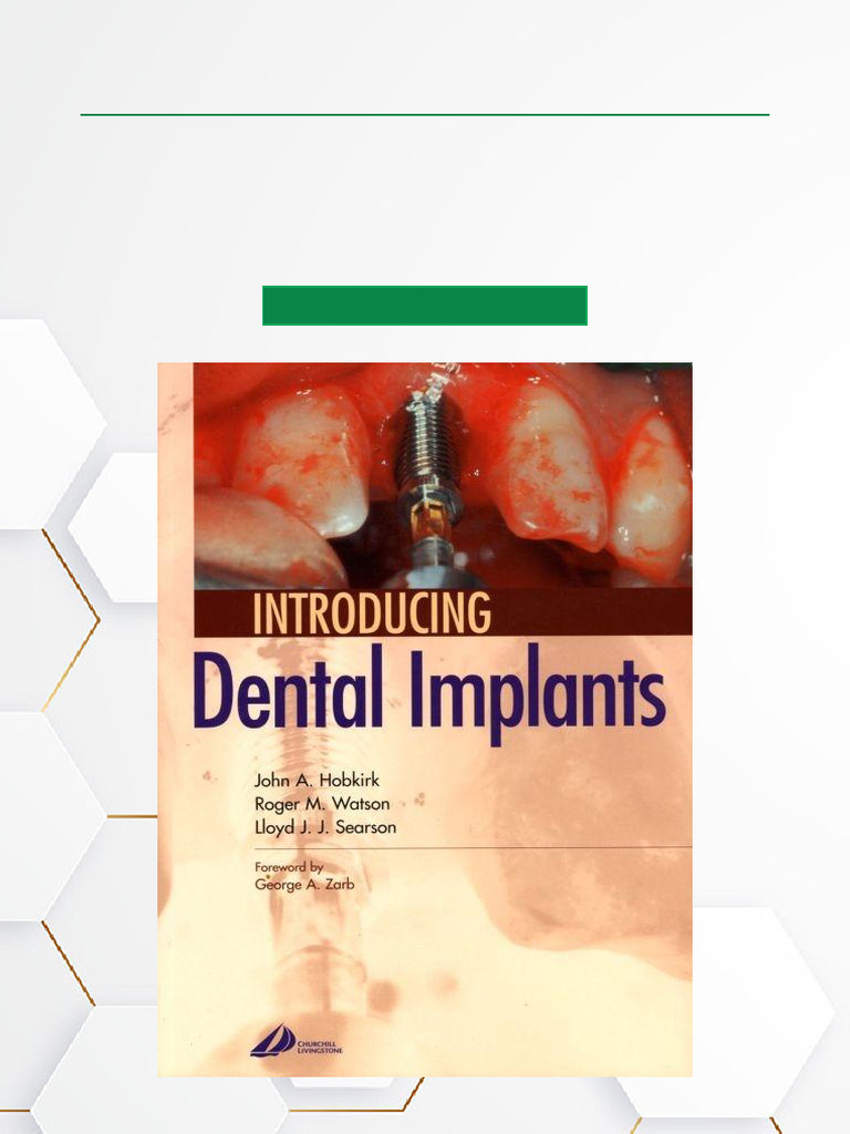 Download Introducing Dental Implants | PDF | Dental Implant | Human Tooth