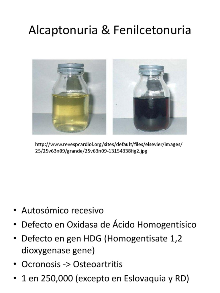 alcaptonuria-pdf