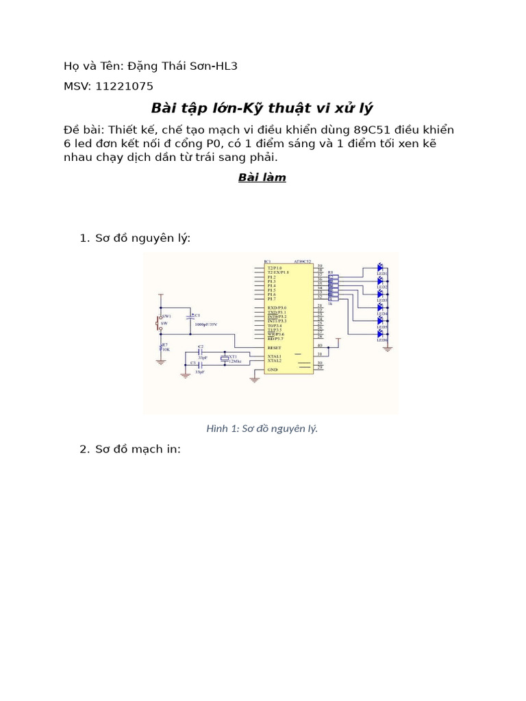 BTLVXL Dts | PDF