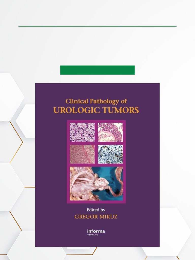 Clinical Pathology of Urological Tumors | PDF | Carcinoma | Kidney