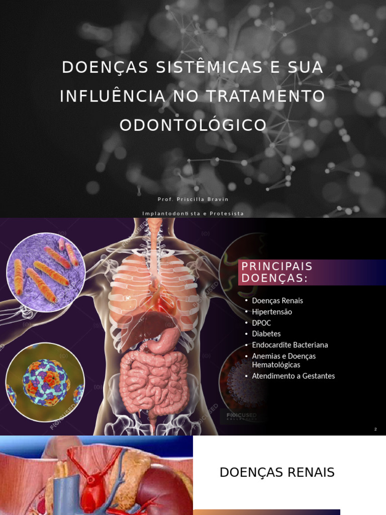 Doenças Sistêmicas | PDF | Diabetes | Doença de obstrução pulmonar crônica