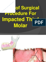 Impaction 3