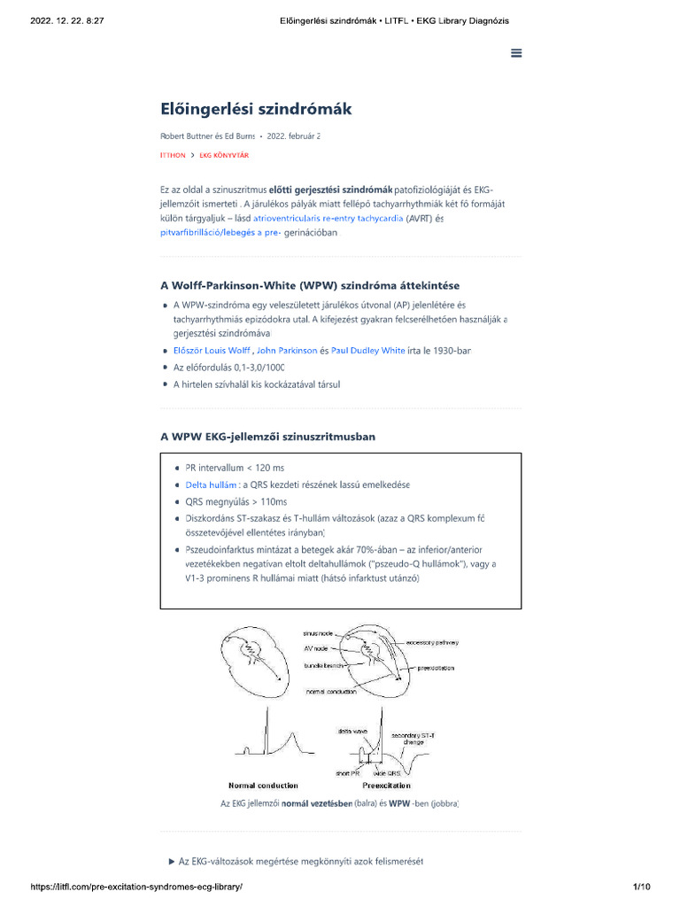 AVRT | PDF