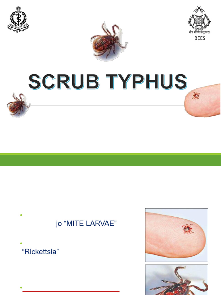 Scrub Typhus: Symptoms and Risks | PDF