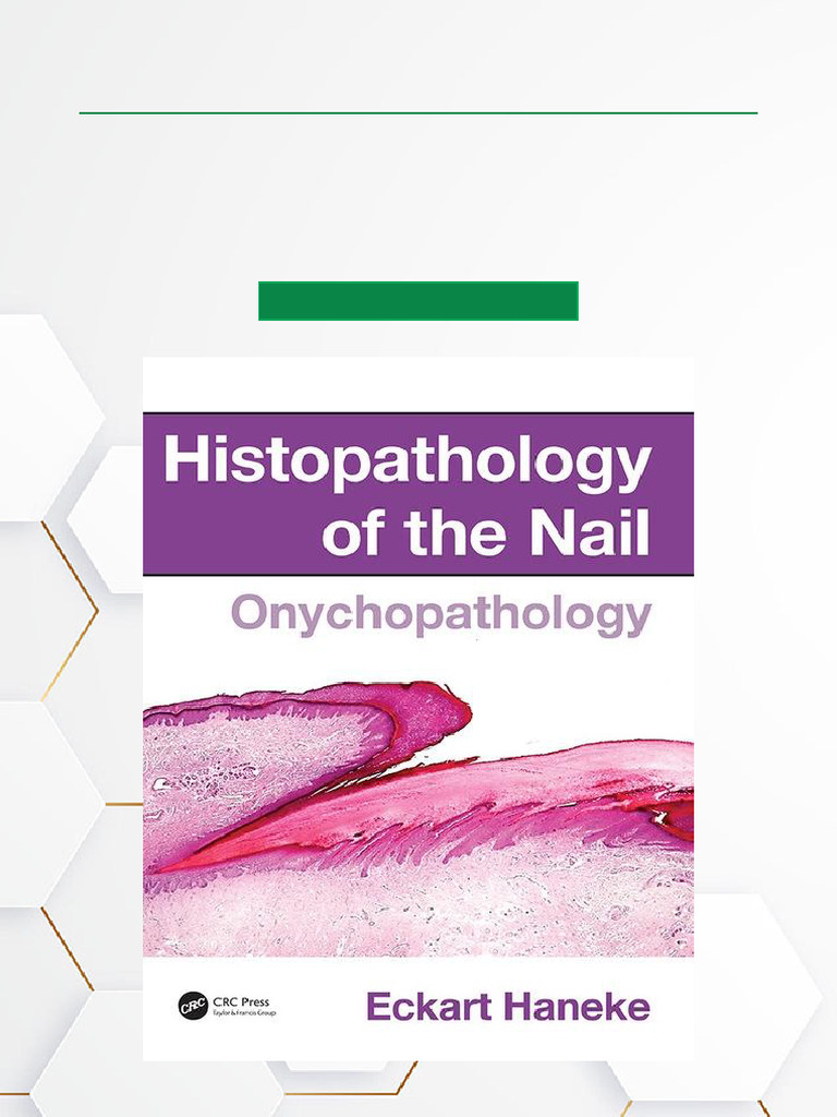 Histopathology of The Nail Onychopathology, 1st Edition ISBN 1482212323 ...
