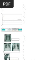 Nódulo de Ghon e Complexo de Ranke | PDF | Tuberculose | Mycobacterium ...