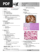 Download CNS Tumors by sarguss14 SN8679876 doc pdf