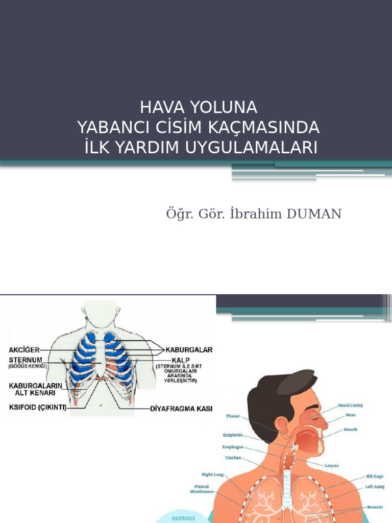 Yabancı Cisim Kaçmalarında Ilk Yardım | PDF