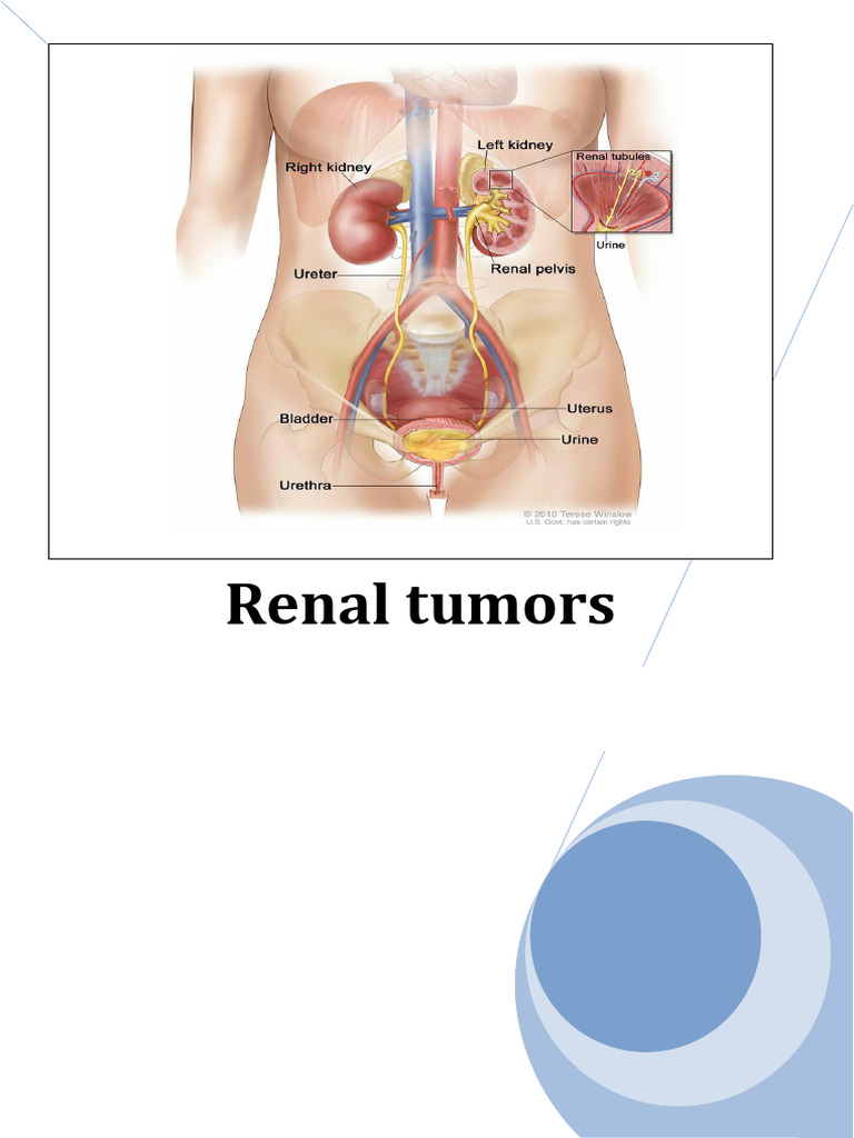 Overview of Renal Tumors and Types | PDF | Lymphatic System | Carcinoma