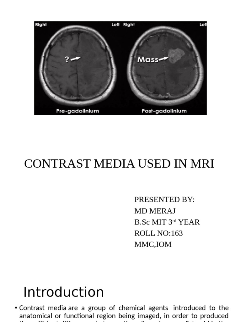 MR Contrast Agents Overview | PDF | Magnetic Resonance Imaging ...
