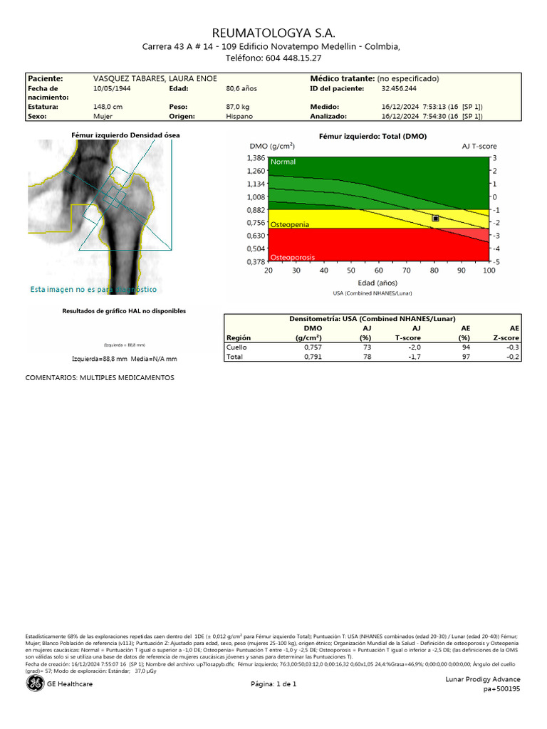 Informe de Densitometría Ósea Fémur Izquierdo | PDF | Medicina CLINICA ...