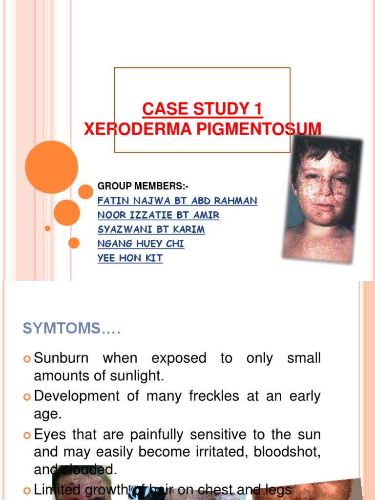 Case Study 1 Xeroderma Pigmentosum: Group Members | PDF | Dna Repair ...