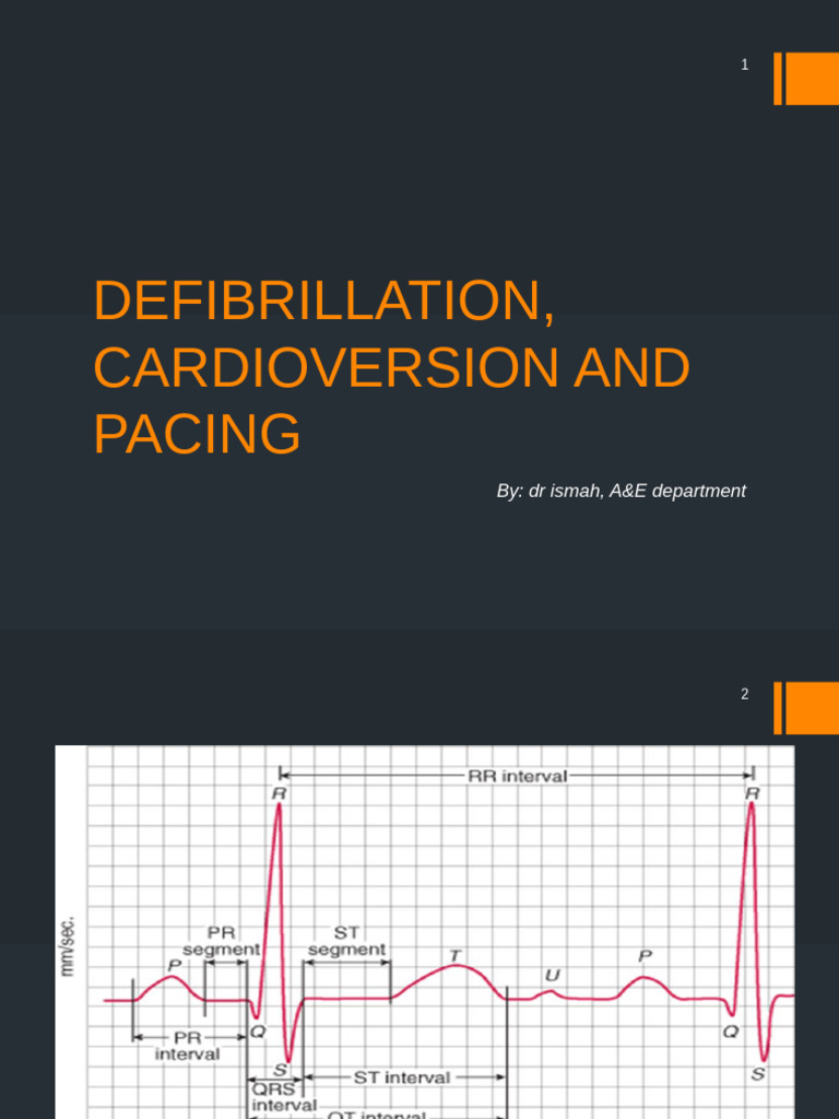 Defibrillation, Cardioversion and Pacing: By: DR Ismah, A&E Department ...